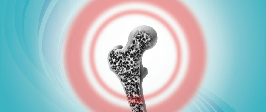 densitometria a bologna per prevenzione osteoporosi